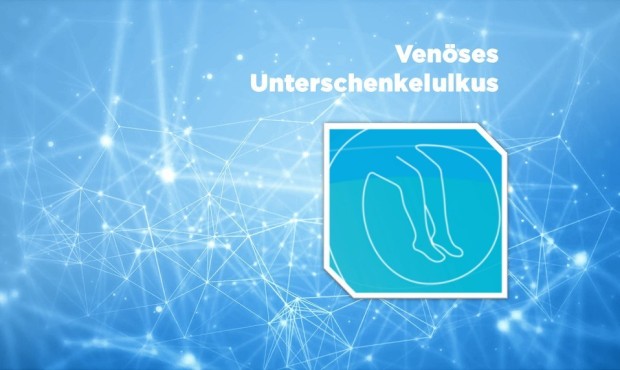 Diagnose & Therapie des venösen Unterschenkelulkus